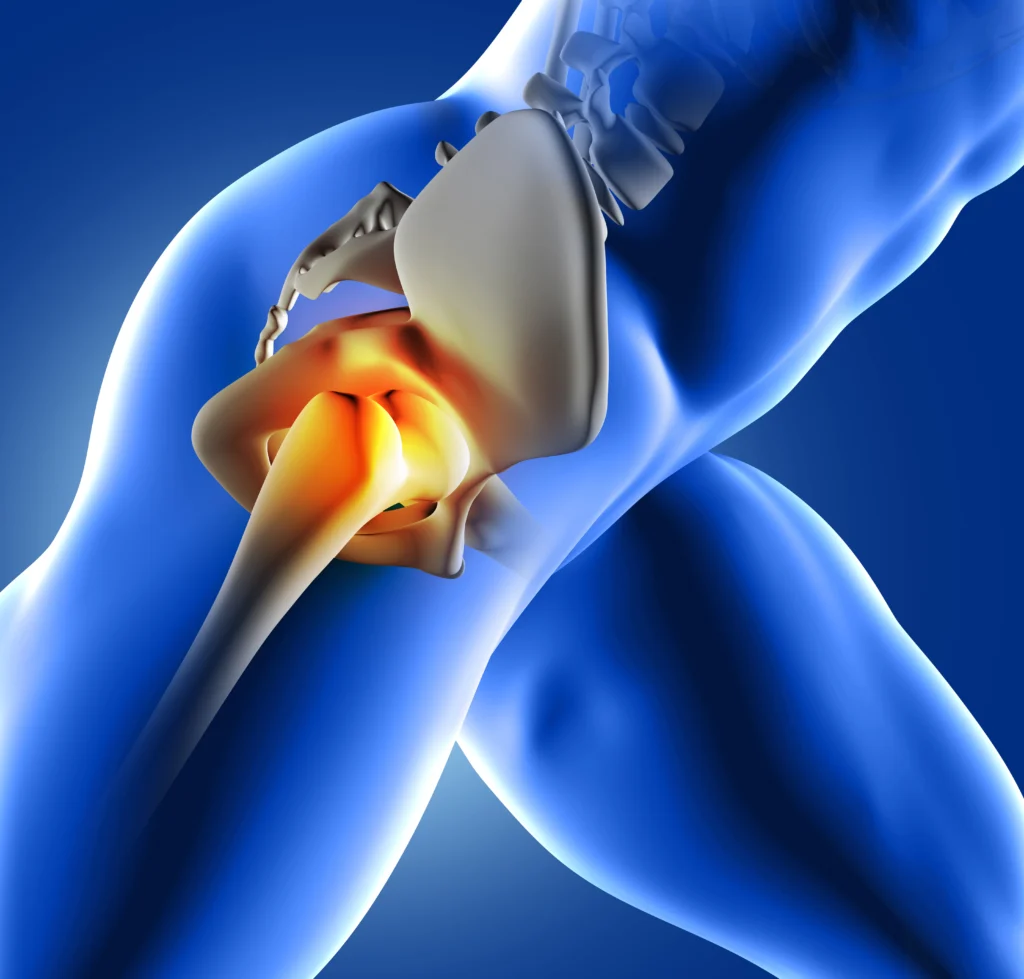 4 Steps For Managing Joint Stiffness After 50 Joint Stiffness hip