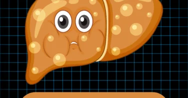 Signs of fatty liver