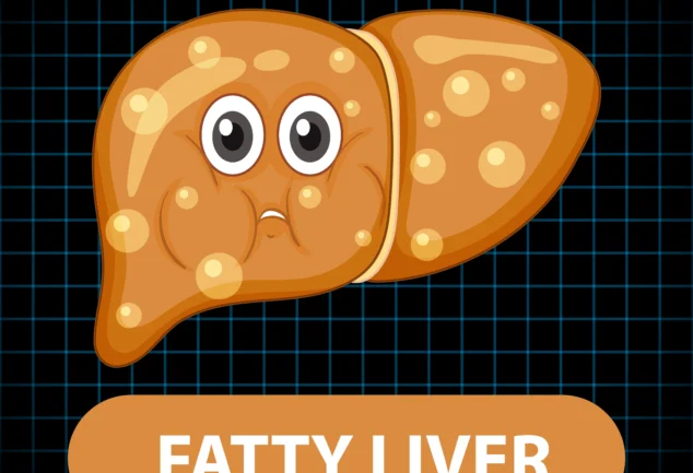 Signs of fatty liver