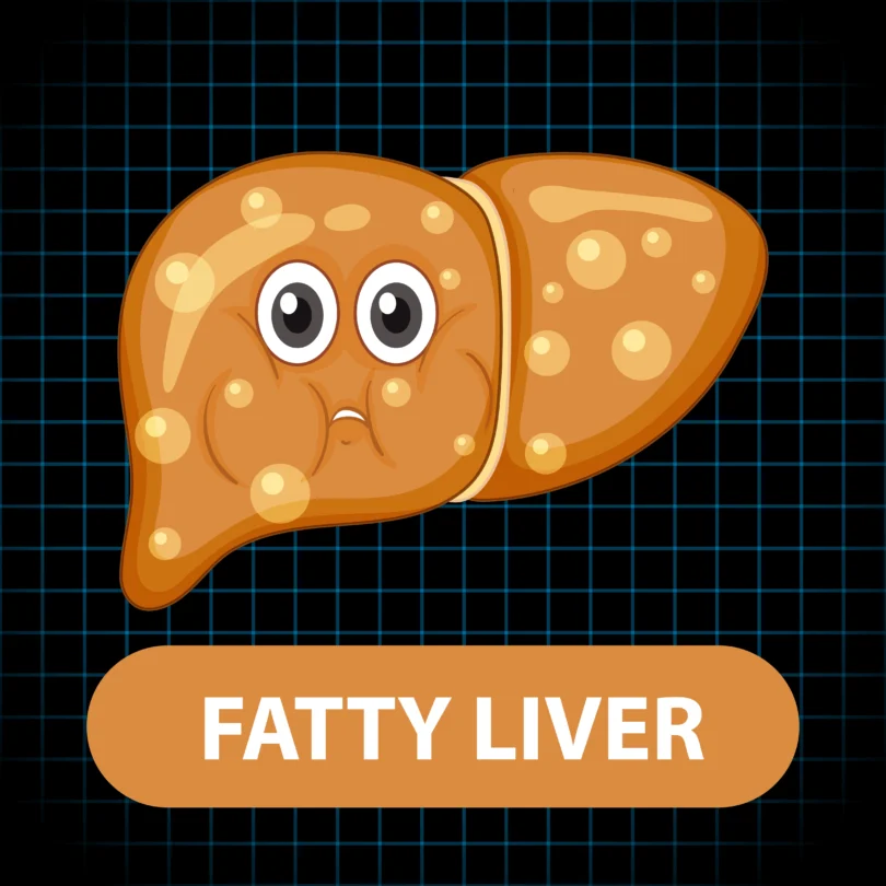 Signs of fatty liver